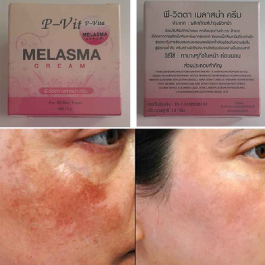 Bioaqua P Vita Melasma Mesta Whitening Cream -10 gm (Thailand)